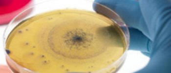 Bakteri Baik di Vagina