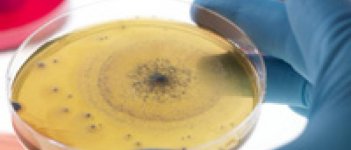 Bakteri Baik di Vagina