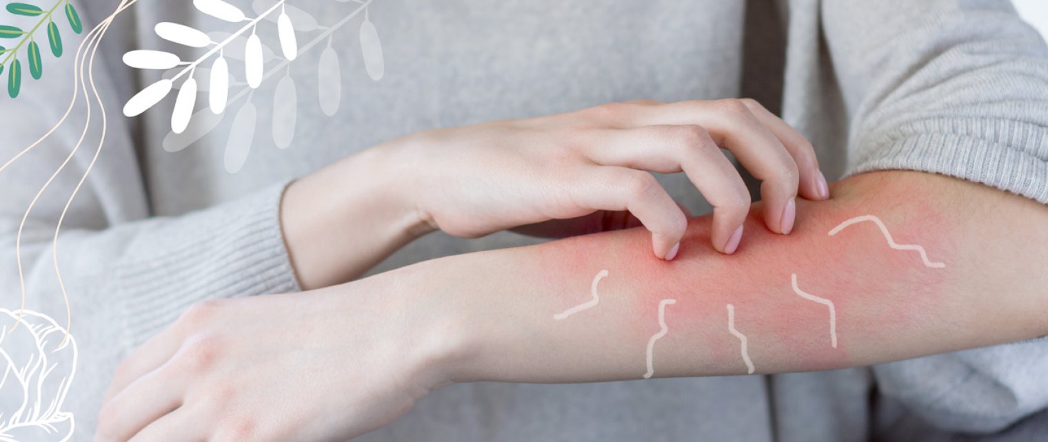 Cara Cegah Ruam Kulit Saat Menopause