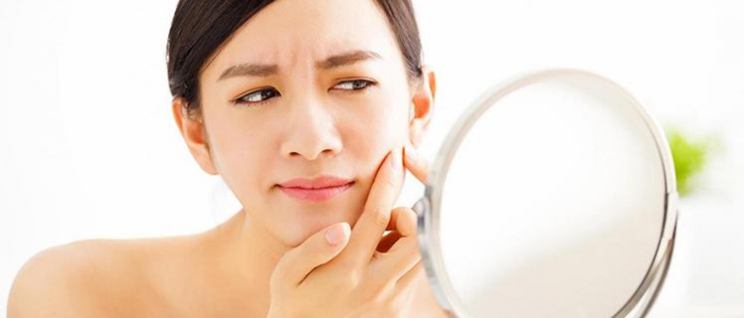 Jerawat Pas Menstruasi? NO WAY!