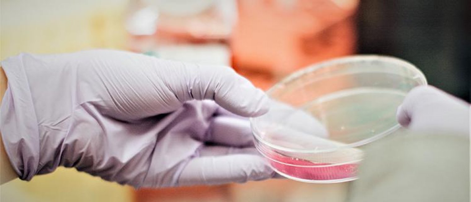 Tes Kanker Serviks Terbaru Bisa Mendeteksi 100% Tepat!