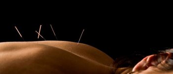 Akupunktur Ampuh Redakan Nyeri Menstruasi