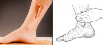 Acupressure Bisa Mengurangi Gejala PMS Kamu, Lho!