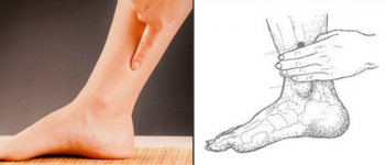 Acupressure Bisa Mengurangi Gejala PMS Kamu, Lho!