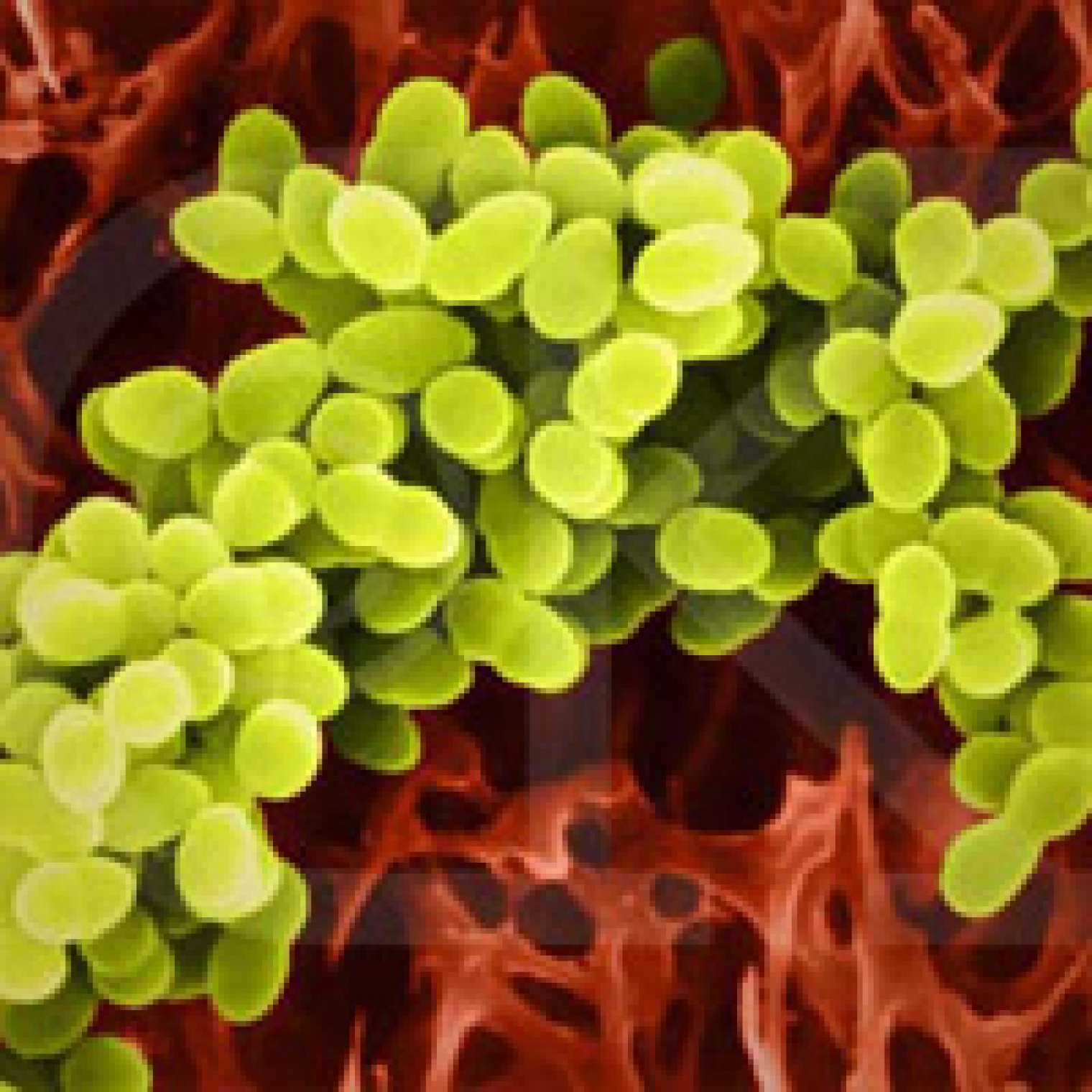 Apa tuh, Toxic Shock Syndrome?