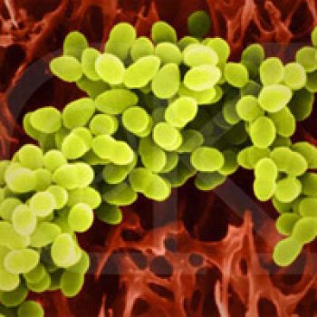 Apa tuh, Toxic Shock Syndrome?