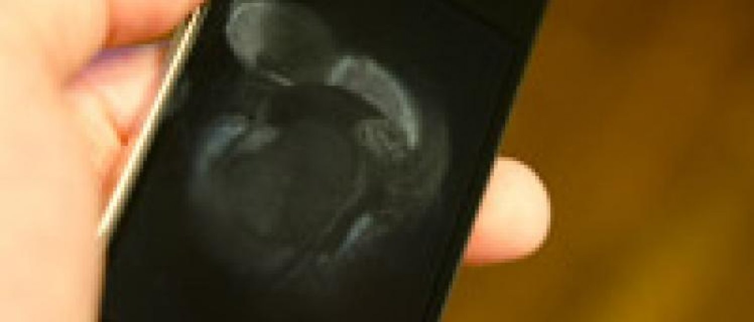 6 Kebiasaan yang Bisa Memperburuk Jerawatmu!