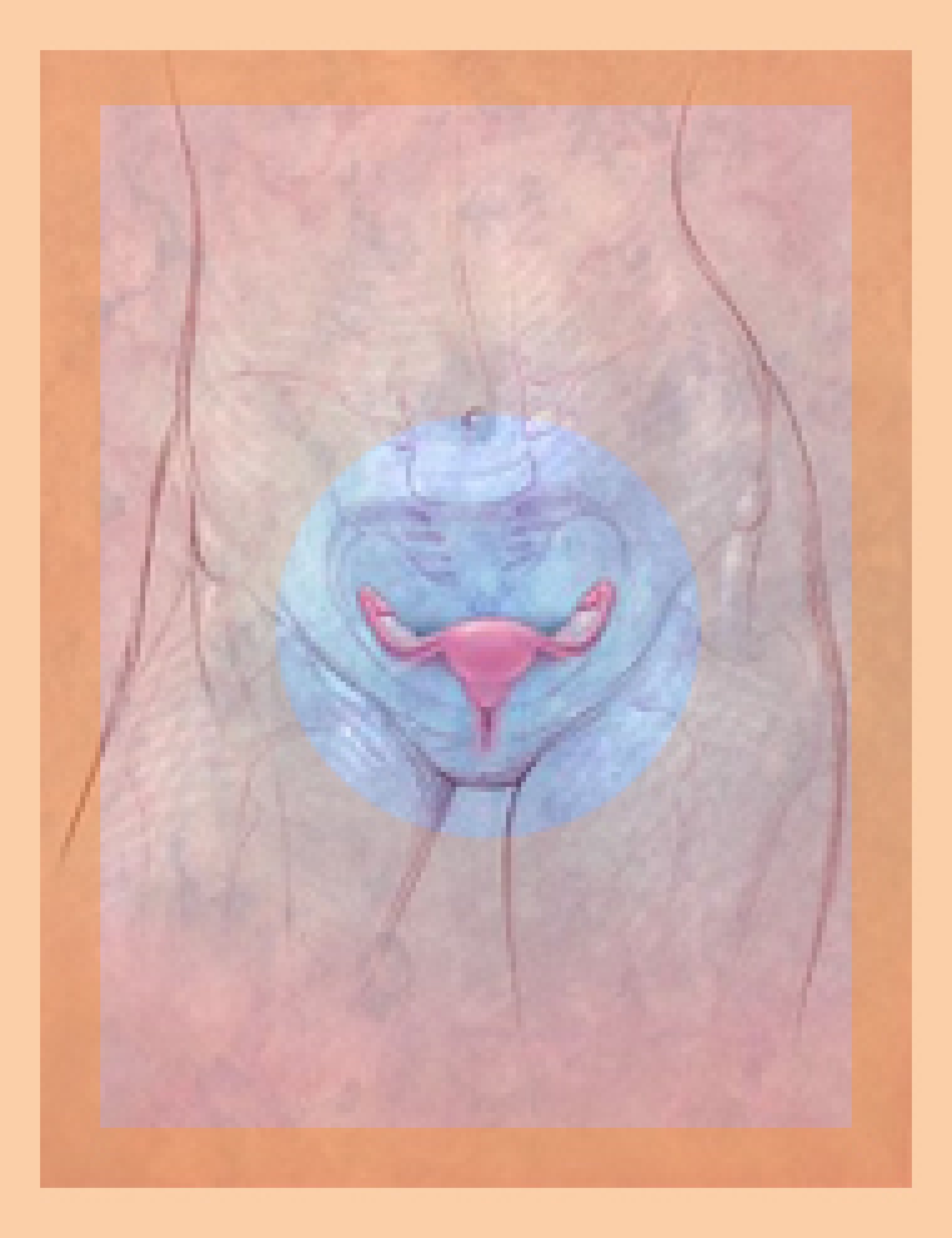 Radang Vagina Bisa Berubah Jadi Kanker Rahim?!