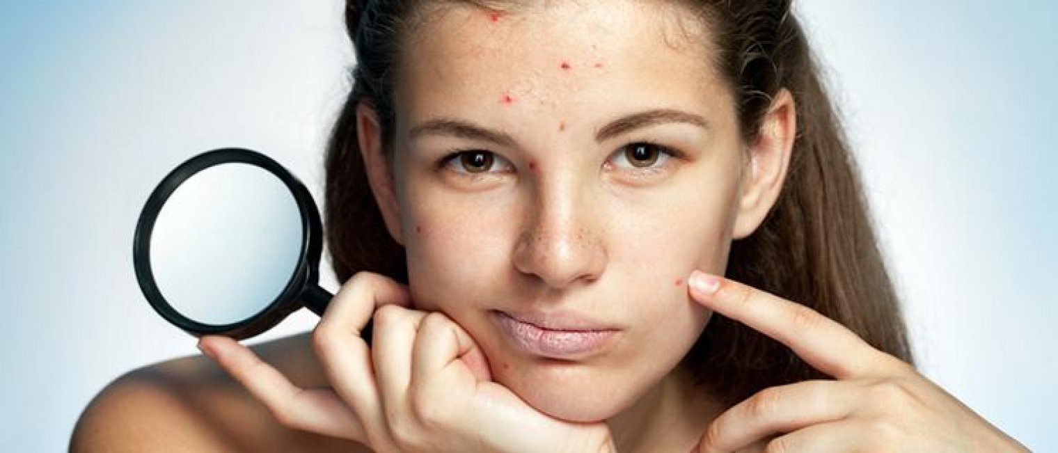 Ada Apa Sama Kulitku Pas Menstruasi?