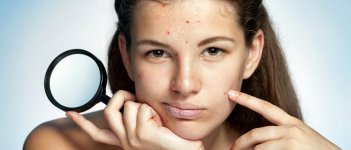 Ada Apa Sama Kulitku Pas Menstruasi?