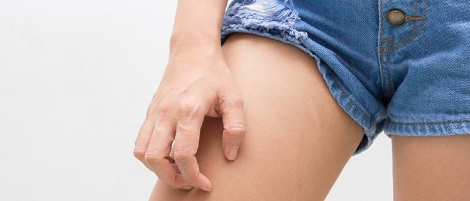 Penyebab Infeksi dan Bau di Area Miss V