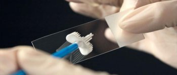 Pentingnya Pap Smear Untuk Hidup Kamu